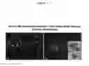 Fig. 02 - Methods and compositions for mitochondrial replacement therapy