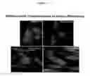 Fig. 03 - Methods and compositions for mitochondrial replacement therapy