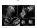 Fig. 07 - Methods and compositions for mitochondrial replacement therapy