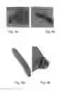 Fig. 06 - Methods of and compositions for inhibiting the proliferation of mammalian cells