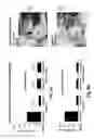 Fig. 09 - Further Use of Protein Kinase N Beta