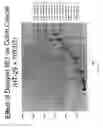Fig. 45 - Methods of treating pancreatic or liver cancer using hedgehog antagonists