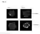 Fig. 04 - Method Of Reducing Tissue Loss In Pancreatic Islet Cell Transplantation