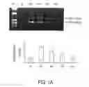 Fig. 02 - Hypoxia induced mitogenic factor