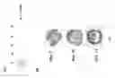 Fig. 09 - SUPPRESSION OF ALLERGIC INFLAMMATION BY ASCARIS HEME-BINDING PROTEIN (HBP)