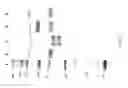 Fig. 13 - SUPPRESSION OF ALLERGIC INFLAMMATION BY ASCARIS HEME-BINDING PROTEIN (HBP)