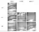 Fig. 01 - Silk Fibroin Hydrogels and Uses Thereof