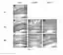 Fig. 10 - Silk Fibroin Hydrogels and Uses Thereof