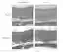 Fig. 12 - Silk Fibroin Hydrogels and Uses Thereof