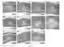 Fig. 13 - Silk Fibroin Hydrogels and Uses Thereof