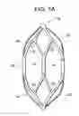 Fig. 07 - Medical device having bonding regions and method of making the same