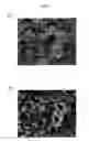 Fig. 06 - Catalyst layer for fuel cell membrane electrode assembly, fuel cell membrane electrode assembly using the catalyst layer, fuel cell, and method for producing the catalyst layer