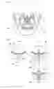 Fig. 02 - APPARATUS OF LIQUID INJECTING FOR LIFTING MAXILLARY SINUS MUCOUS MEMBRANCE AND THE METHOD FOR THE SAME UTILIZING THIS APPARATUS
