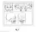 Fig. 04 - Method and Apparatus for Electronically Modeling and Manufacturing Dentures