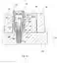 Fig. 10 - Method of installing a prosthesis in a jawbone of a patient