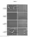 Fig. 08 - Composition and method for flushing and cold/cryo preserving organs, tissues, and cells