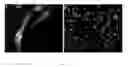 Fig. 10 - HUMAN GONADAL STEM CELLS