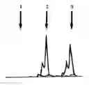 Fig. 01 - METHOD FOR THE DETERMINATION OF DATA FOR THE PREPARATION OF THE DIAGNOSIS OF PHAKOMATOSIS