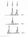 Fig. 02 - METHOD FOR THE DETERMINATION OF DATA FOR THE PREPARATION OF THE DIAGNOSIS OF PHAKOMATOSIS