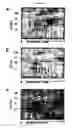 Fig. 07 - Depletion of plasma proteins