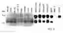 Fig. 06 - Tumor suppressor gene