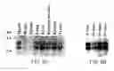 Fig. 07 - Tumor suppressor gene