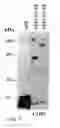 Fig. 08 - Tumor suppressor gene