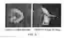 Fig. 09 - Tumor suppressor gene