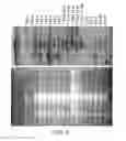 Fig. 10 - Tumor suppressor gene