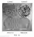 Fig. 11 - Tumor suppressor gene