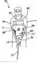 Fig. 01 - Golf swing formation aid