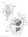 Fig. 02 - Golf swing formation aid