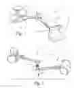 Fig. 02 - Lip strengthening device