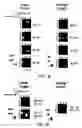 Fig. 04 - Methods of using an array of pooled probes in genetic analysis
