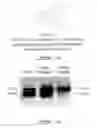 Fig. 08 - SCREENING ASSAY TO IDENTIFY CORRECTORS OF PROTEIN TRAFFICKING DEFECTS