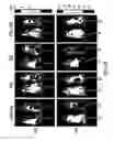 Fig. 27 - Targeting CDK4 and CDK6 in cancer therapy
