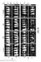 Fig. 31 - Targeting CDK4 and CDK6 in cancer therapy