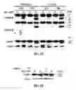 Fig. 34 - Targeting CDK4 and CDK6 in cancer therapy
