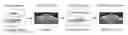 Fig. 01 - Method to enhance tissue regeneration