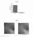 Fig. 06 - COSMETIC COMPOSITION COMPRISING VITAMIN U AS ACTIVE INGREDIENT FOR HEALING WOUNDS AND REDUCING WRINKLES