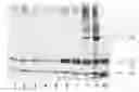 Fig. 01 - Method for Concentrating, Purifying and Removing Prion Protein