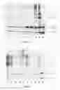 Fig. 02 - Method for Concentrating, Purifying and Removing Prion Protein