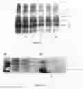 Fig. 07 - Method for Concentrating, Purifying and Removing Prion Protein