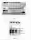 Fig. 08 - Method for Concentrating, Purifying and Removing Prion Protein