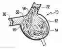 Fig. 01 - Method for making a blood pump
