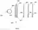 Fig. 04 - External anchoring configurations for modular gastrointestinal prostheses