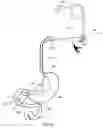 Fig. 15 - External anchoring configurations for modular gastrointestinal prostheses