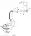 Fig. 16 - External anchoring configurations for modular gastrointestinal prostheses