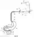 Fig. 17 - External anchoring configurations for modular gastrointestinal prostheses