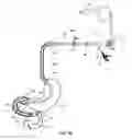 Fig. 19 - External anchoring configurations for modular gastrointestinal prostheses